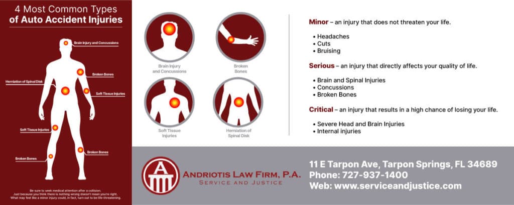 4 Most Common Types of Auto Accident Injuries